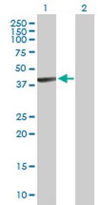 PANK1 Antibody in Western Blot (WB)