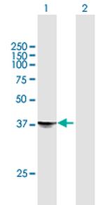 STX18 Antibody in Western Blot (WB)