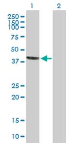 STX18 Antibody in Western Blot (WB)