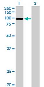 CPSF2 Antibody in Western Blot (WB)