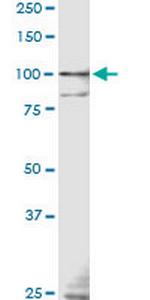 TLR9 Antibody in Western Blot (WB)