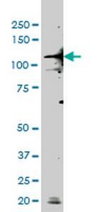 TLR9 Antibody in Western Blot (WB)