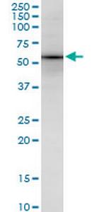 SOX18 Antibody in Western Blot (WB)