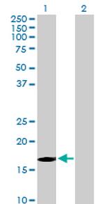 FBXW5 Antibody in Western Blot (WB)