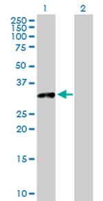 TOLLIP Antibody in Western Blot (WB)