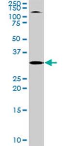 TOLLIP Antibody in Western Blot (WB)