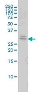 TOLLIP Antibody in Western Blot (WB)