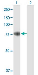 PRMT7 Antibody in Western Blot (WB)