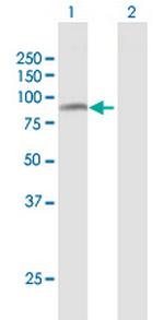 PRMT7 Antibody in Western Blot (WB)