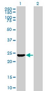 EXOSC4 Antibody in Western Blot (WB)