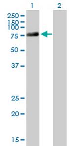 DDX4 Antibody in Western Blot (WB)