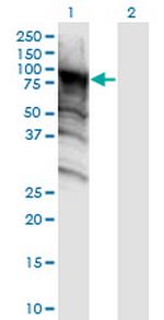 DDX4 Antibody in Western Blot (WB)