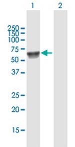 UGT1A7 Antibody in Western Blot (WB)