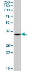 LZTFL1 Antibody in Western Blot (WB)