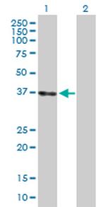 LZTFL1 Antibody in Western Blot (WB)