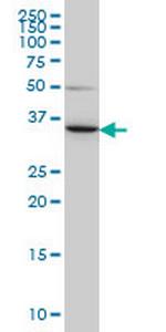 LZTFL1 Antibody in Western Blot (WB)