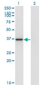 LZTFL1 Antibody in Western Blot (WB)