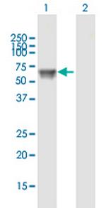 UGT1A9 Antibody in Western Blot (WB)