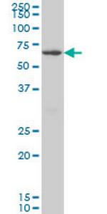 CROT Antibody in Western Blot (WB)