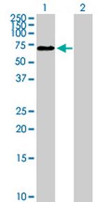 C1orf181 Antibody in Western Blot (WB)