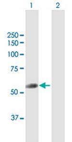 TRIT1 Antibody in Western Blot (WB)