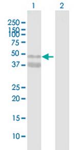 ASPN Antibody in Western Blot (WB)