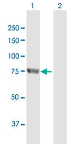 RBM35A Antibody in Western Blot (WB)