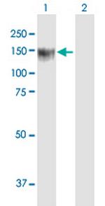 BCOR Antibody in Western Blot (WB)