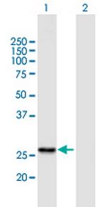 RG9MTD1 Antibody in Western Blot (WB)