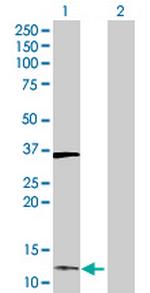 DUSP23 Antibody in Western Blot (WB)