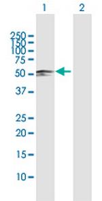 SARS2 Antibody in Western Blot (WB)