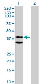 C21orf55 Antibody in Western Blot (WB)