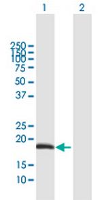 ODAM Antibody in Western Blot (WB)