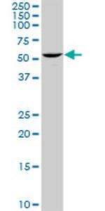 UCKL1 Antibody in Western Blot (WB)