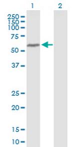 BANP Antibody in Western Blot (WB)