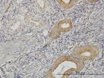 FLJ20643 Antibody in Immunohistochemistry (Paraffin) (IHC (P))