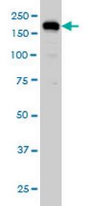 USP47 Antibody in Western Blot (WB)