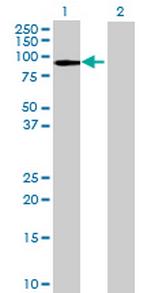 CCDC40 Antibody in Western Blot (WB)