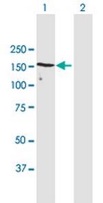 UACA Antibody in Western Blot (WB)