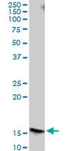 FLJ10292 Antibody in Western Blot (WB)