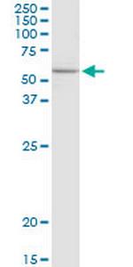 ELP3 Antibody in Western Blot (WB)