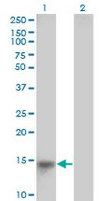 LRRC5 Antibody in Western Blot (WB)