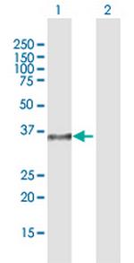 DPPA4 Antibody in Western Blot (WB)