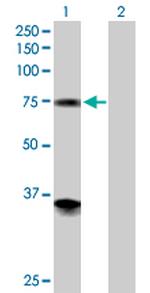 PGM2 Antibody in Western Blot (WB)