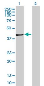 FLJ10986 Antibody in Western Blot (WB)