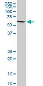 FLJ10986 Antibody in Western Blot (WB)