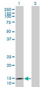 SYNJ2BP Antibody in Western Blot (WB)