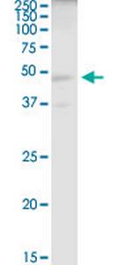 ELAC1 Antibody in Western Blot (WB)