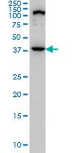 ELAC1 Antibody in Western Blot (WB)