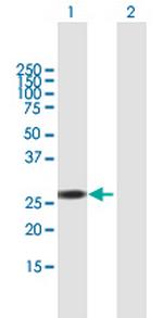 RBM38 Antibody in Western Blot (WB)